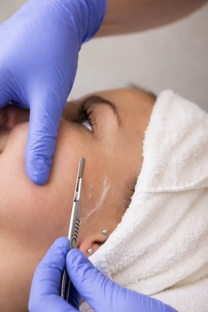 Dermaplaning treatment in Magnolia TX for smoother skin and improved product absorption