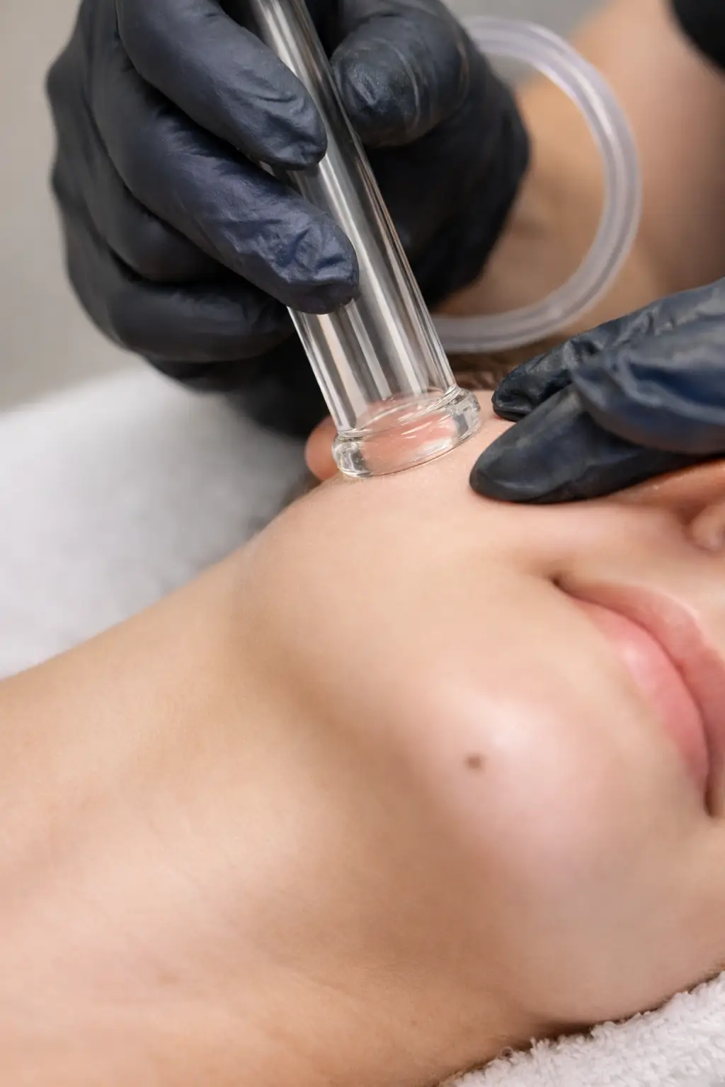 Lymphatic drainage facial to reduce puffiness and support detoxification for healthier skin