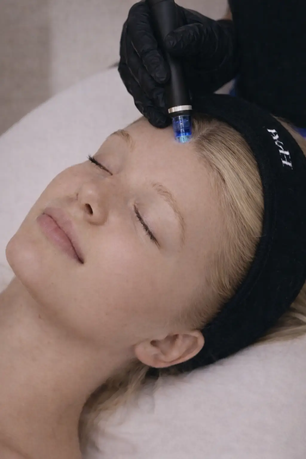 HydraFacial scalp treatment for deep cleansing and healthier hair growth